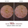 [Dr. Melaxin] Peel Shot Glow White Rice Peeling Ampoule (2.7 fl.oz / 80ml)