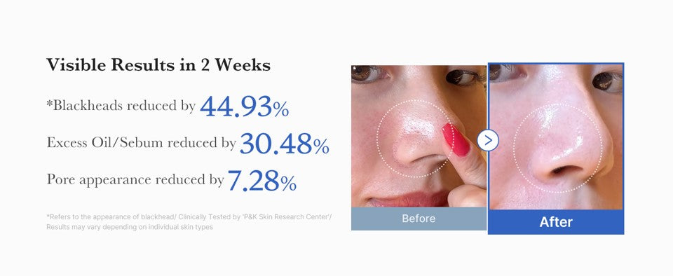 Smart Pack 3: Clear Pores Duo (Acne)