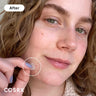 [COSRX] Acne Pimple Master Patch (24 patches, mixed sizes)