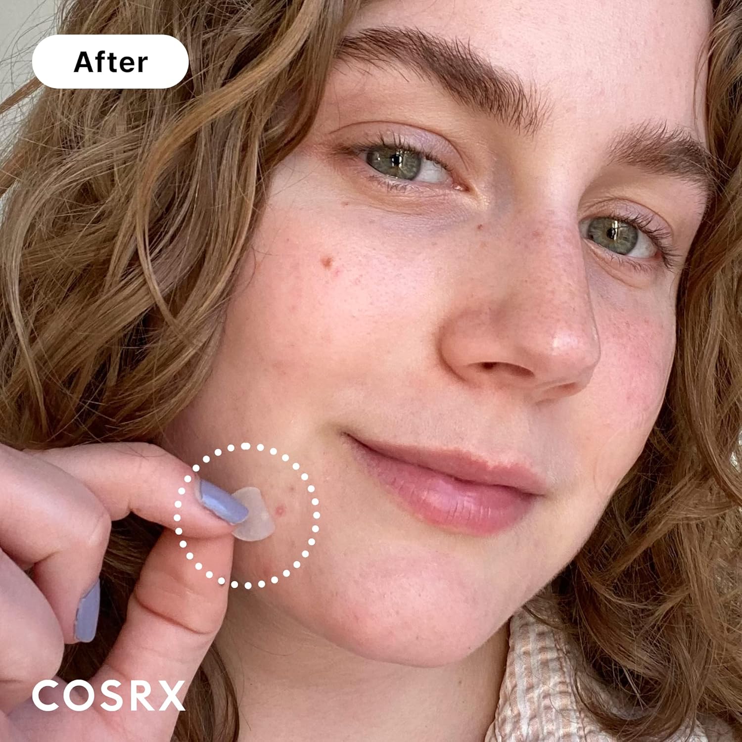[COSRX] Acne Pimple Master Patch (24 patches, mixed sizes)