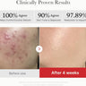 Set 2: Clear Skin Pack (Acne & Breakouts)