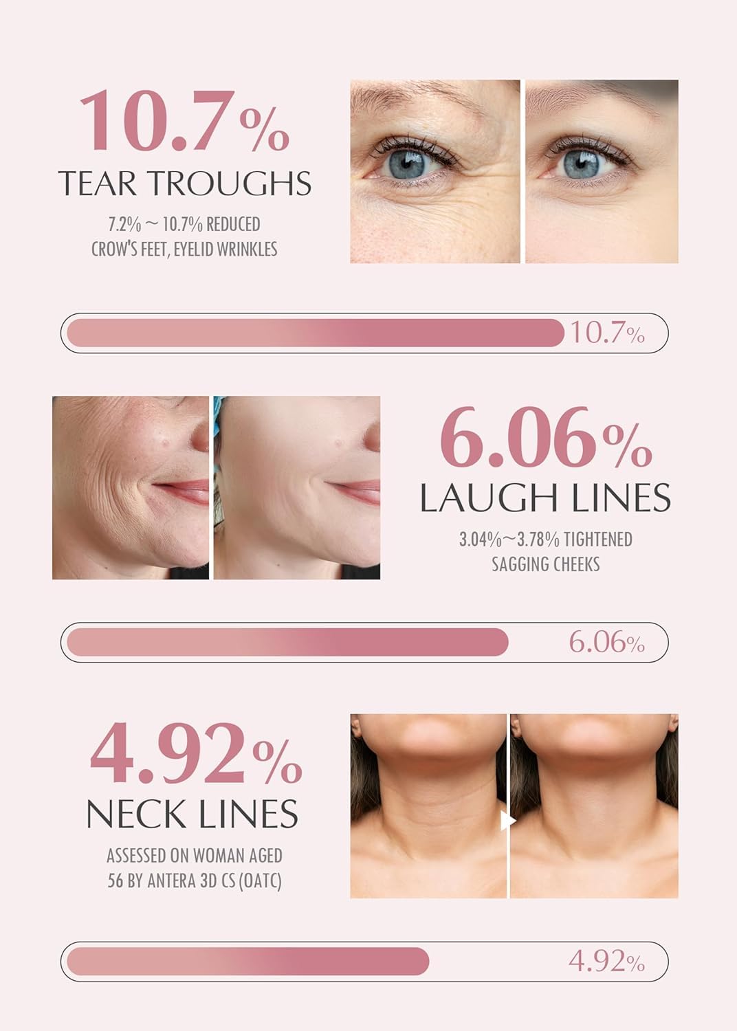 Set 4: Age-Defense Pack (Fine Lines & Wrinkles)
